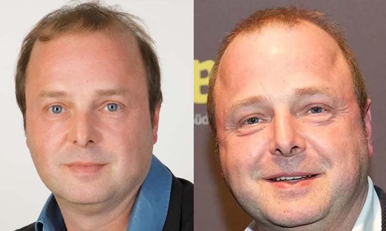 Wolfgang Feindt Todesursache